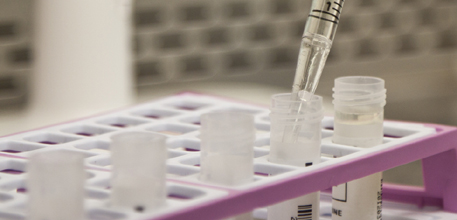 Sampple tubes being filled