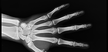 x-ray hand_457x220