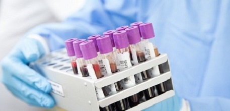 Blood test tubes_457x220 (2