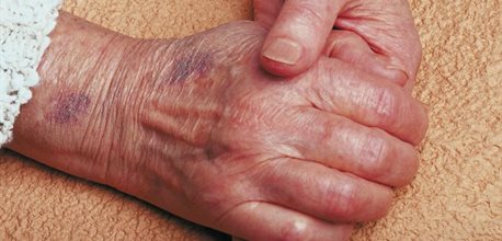 Elderly hands