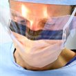 Hip revision surgery in Southampton's dedicated centre