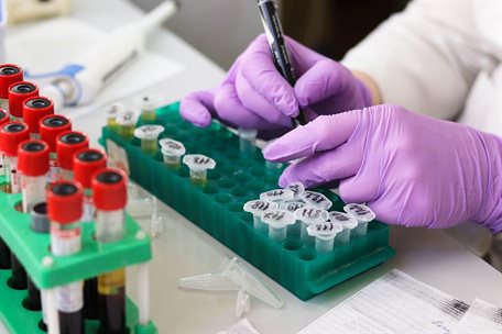 laboratory-3827745_960_720
