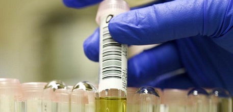 Urine sample_457x220