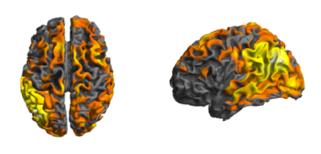 brain scan_457x220