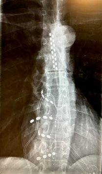 Alison x-ray cropped