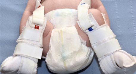 Pavlik harness