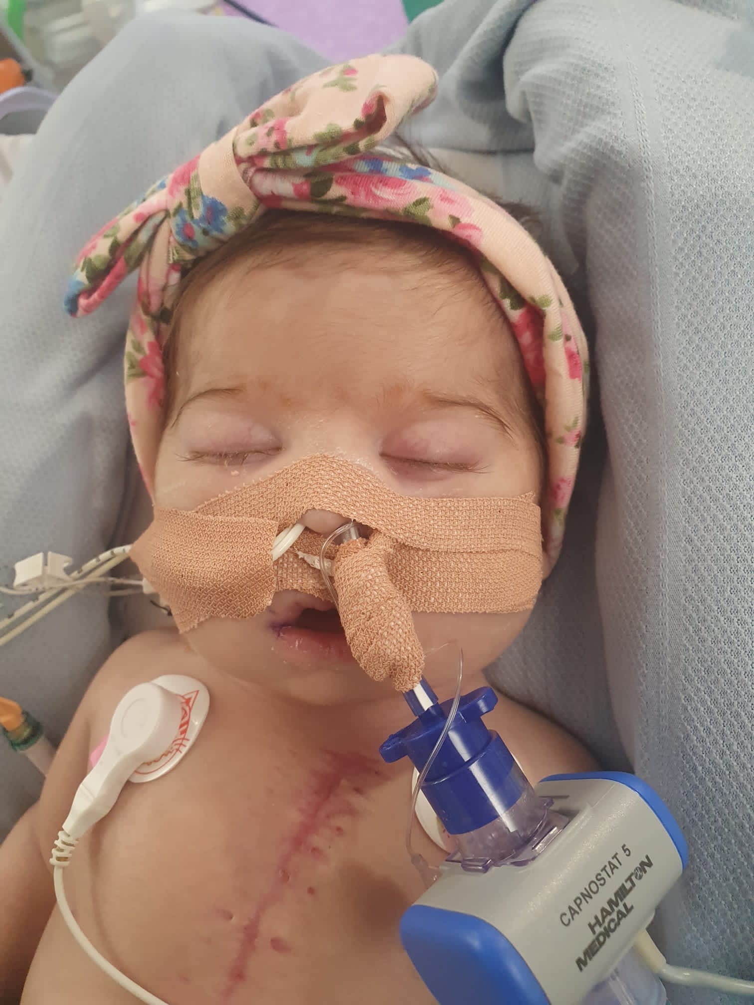Baby Pippa in Southampton Children's Hospital