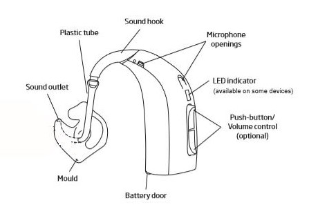 Diagram showing the different parts of a hearing aid