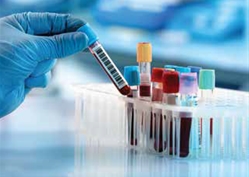 blood test