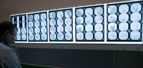 A wall showing scan images on a lightbox.