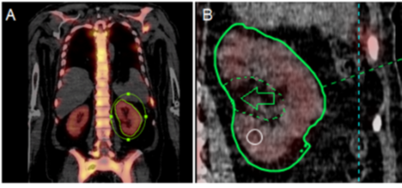 Dosimetry example, full information in caption.