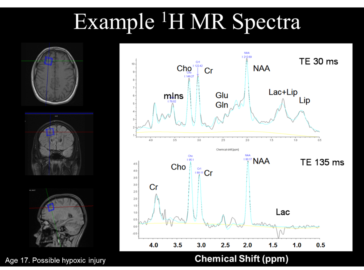 Example 1H MR spectra