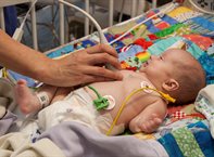 Baby having an echo
