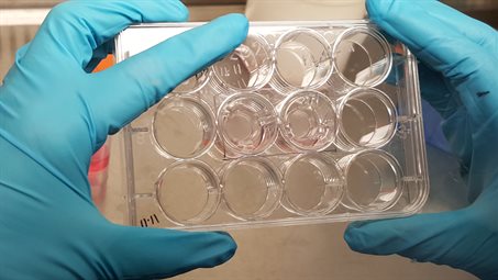 Lining of the nose in lab dish