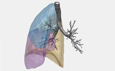lung