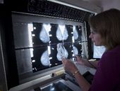 Woman studying mammograms