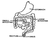 Hirschsprung's Disease