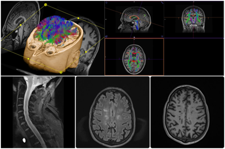 MRI-1