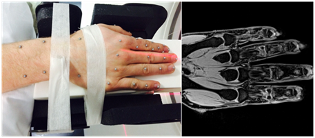 MRI-3