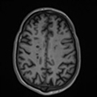 MRI jpeg110x110.jpg
